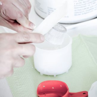 Gebissabdruck - Kieferorthopaedie Aguero