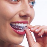 Invisalign - Kieferorthopaedie Susana Aguero